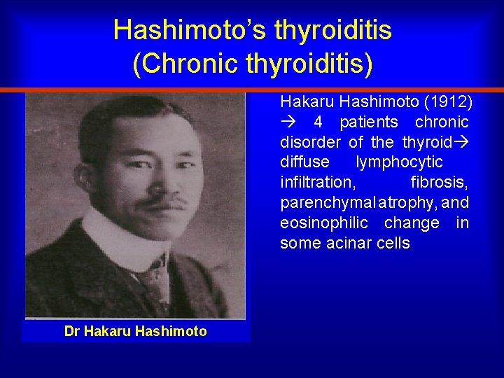 Hashimoto’s thyroiditis (Chronic thyroiditis) Hakaru Hashimoto (1912) 4 patients chronic disorder of the thyroid