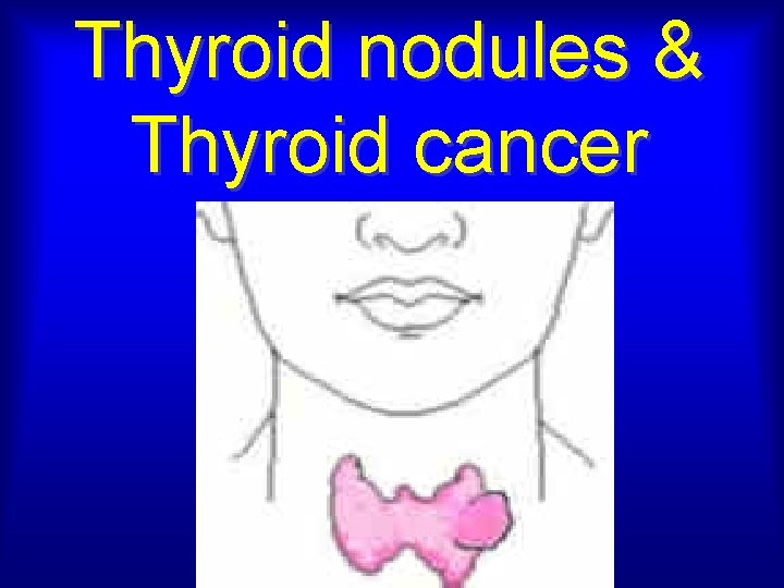 Thyroid nodules & Thyroid cancer 