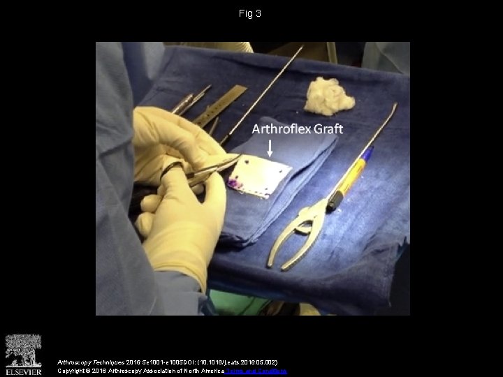 Fig 3 Arthroscopy Techniques 2016 5 e 1001 -e 1005 DOI: (10. 1016/j. eats.
