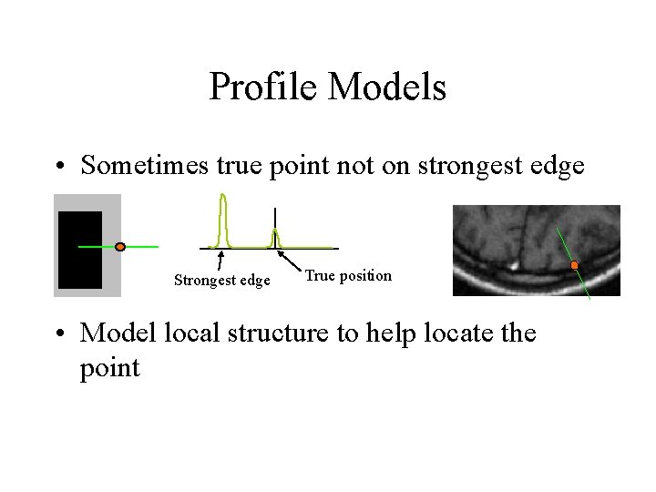 Profile Models • Sometimes true point not on strongest edge Strongest edge True position Profile Models • Sometimes true point not on strongest edge Strongest edge True position