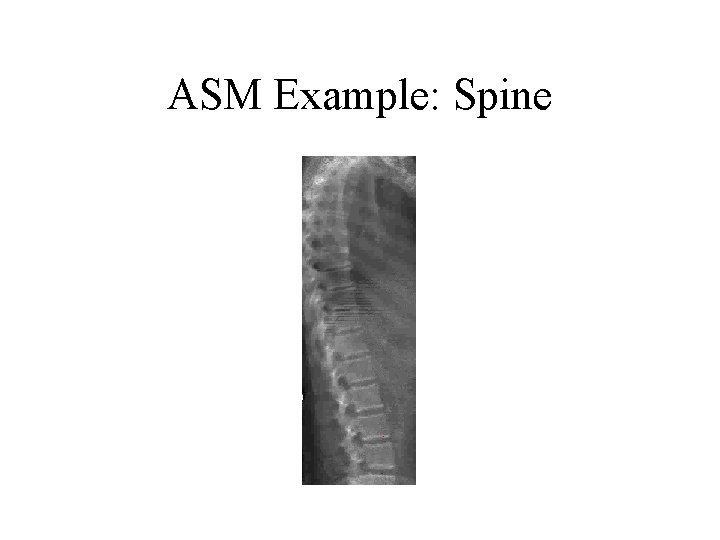ASM Example: Spine ASM Example: Spine