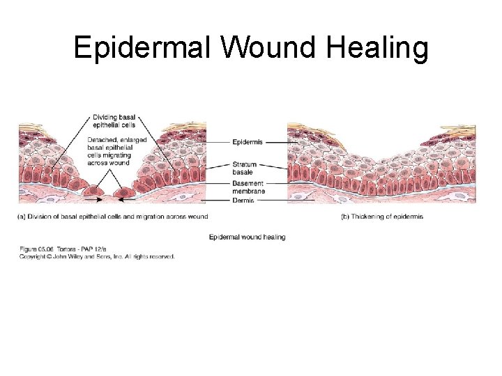 Epidermal Wound Healing 