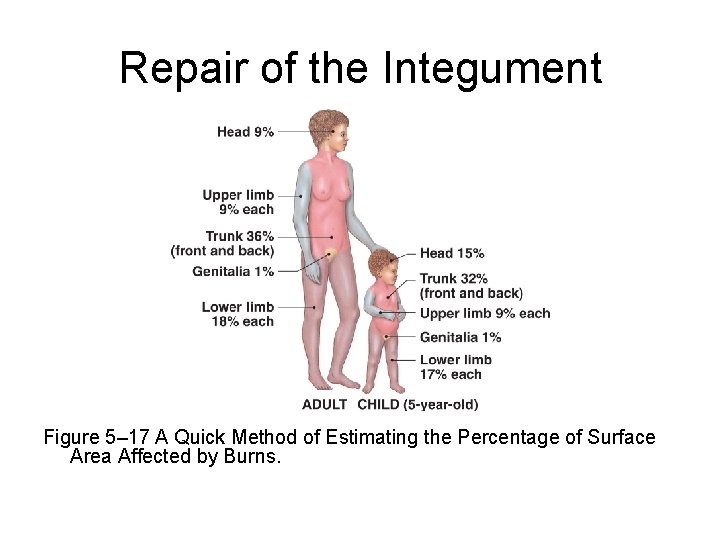 Repair of the Integument Figure 5– 17 A Quick Method of Estimating the Percentage