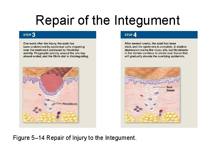 Repair of the Integument Figure 5– 14 Repair of Injury to the Integument. 