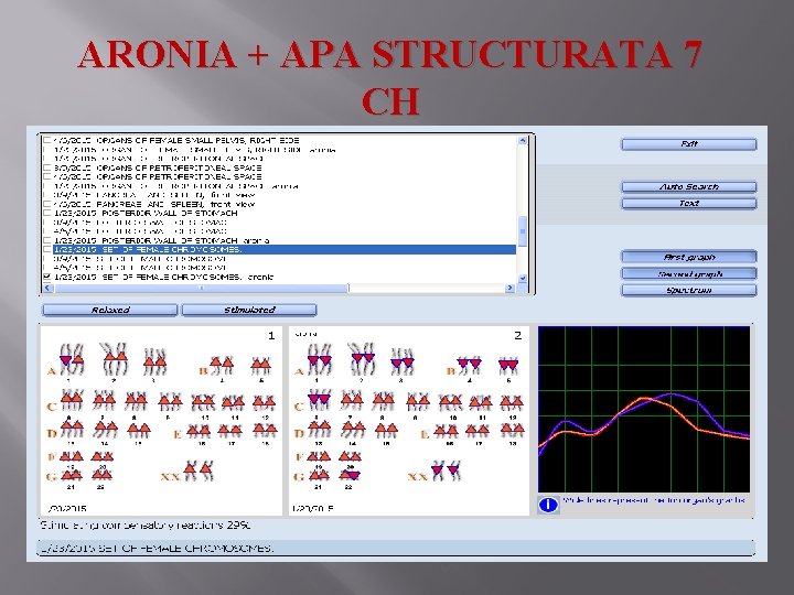 ARONIA + APA STRUCTURATA 7 CH 