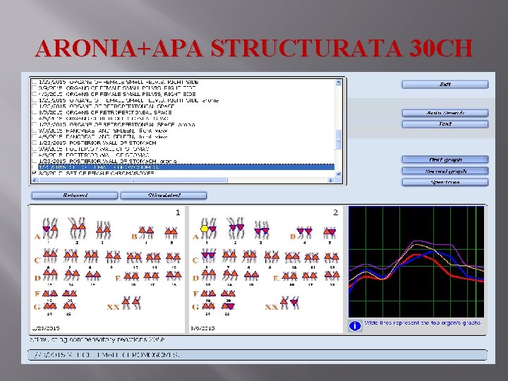 ARONIA+APA STRUCTURATA 30 CH 