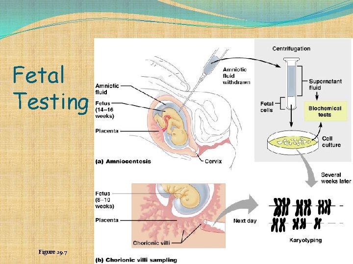 Fetal Testing Figure 29. 7 