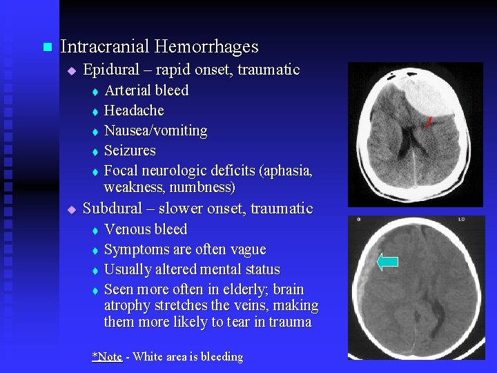 n Intracranial Hemorrhages u Epidural – rapid onset, traumatic t t t u Arterial n Intracranial Hemorrhages u Epidural – rapid onset, traumatic t t t u Arterial