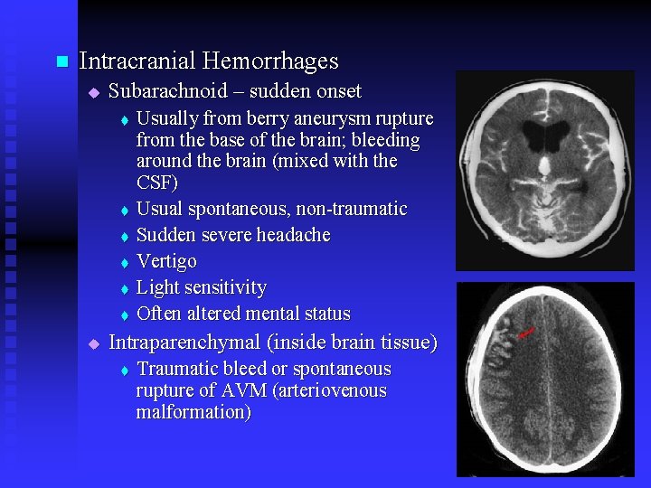 n Intracranial Hemorrhages u Subarachnoid – sudden onset t t t u Usually from n Intracranial Hemorrhages u Subarachnoid – sudden onset t t t u Usually from