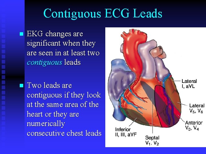 Contiguous ECG Leads n EKG changes are significant when they are seen in at Contiguous ECG Leads n EKG changes are significant when they are seen in at