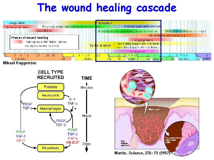 The wound healing cascade Mikael Häggström Martin, Science, 276: 75 (1997) 