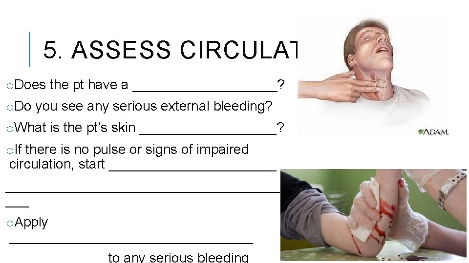 5. ASSESS CIRCULATION o. Does the pt have a __________? o. Do you see