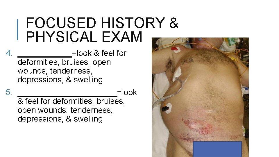 FOCUSED HISTORY & PHYSICAL EXAM 4. ______=look & feel for deformities, bruises, open wounds,