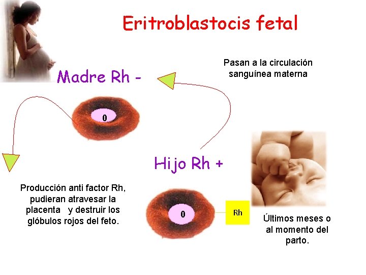 Eritroblastocis fetal Pasan a la circulación sanguínea materna Madre Rh 0 Hijo Rh +