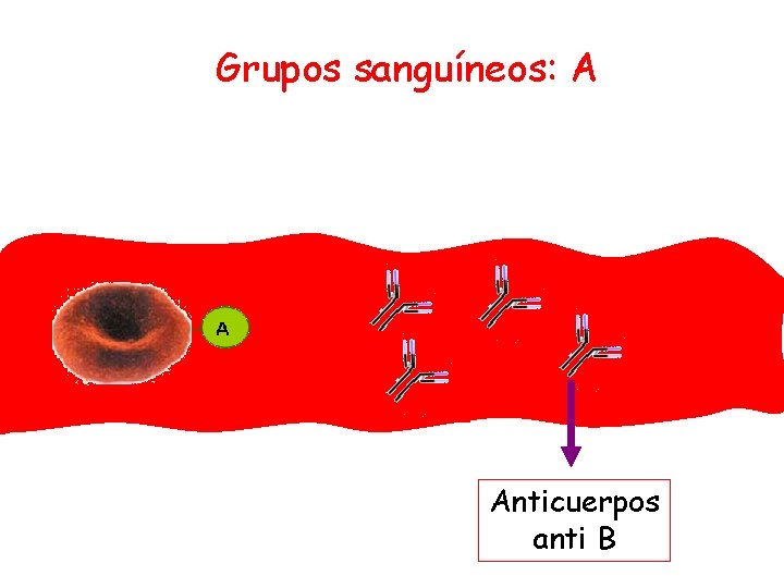 Grupos sanguíneos: A Anticuerpos anti B 