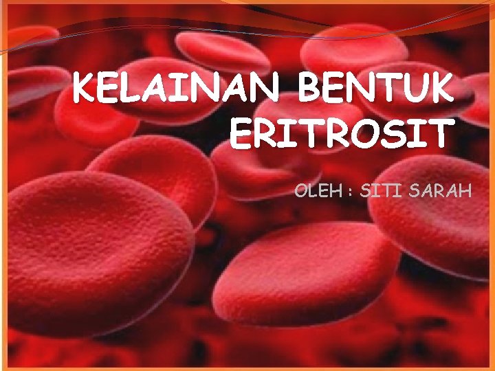 KELAINAN BENTUK ERITROSIT OLEH : SITI SARAH 