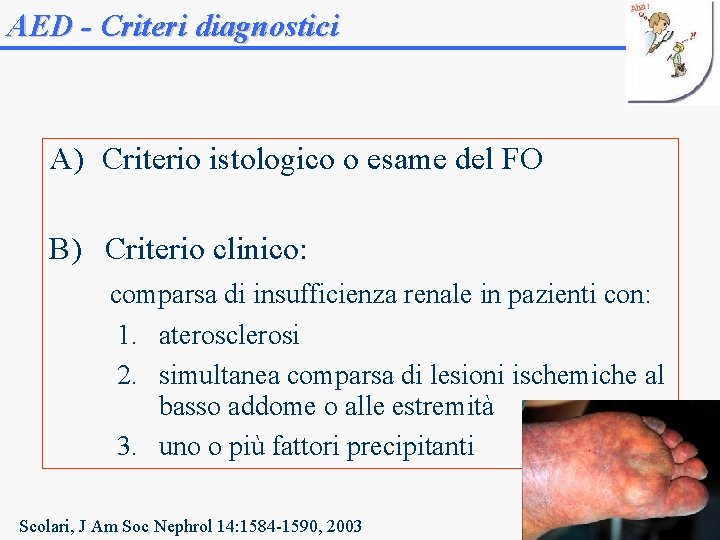 AED - Criteri diagnostici A) Criterio istologico o esame del FO B) Criterio clinico: