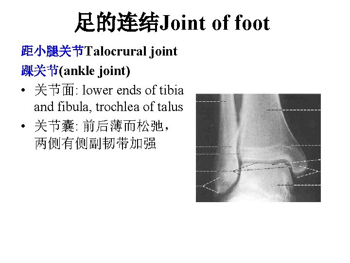 足的连结Joint of foot 距小腿关节Talocrural joint 踝关节(ankle joint) • 关节面: lower ends of tibia and