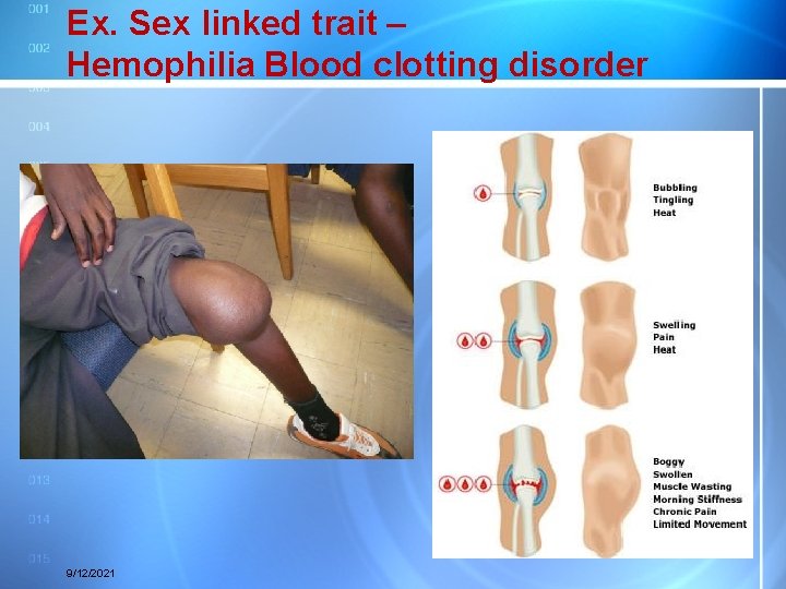 Ex. Sex linked trait – Hemophilia Blood clotting disorder 9/12/2021 