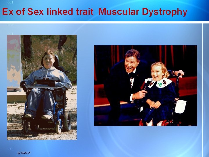 Ex of Sex linked trait Muscular Dystrophy 9/12/2021 