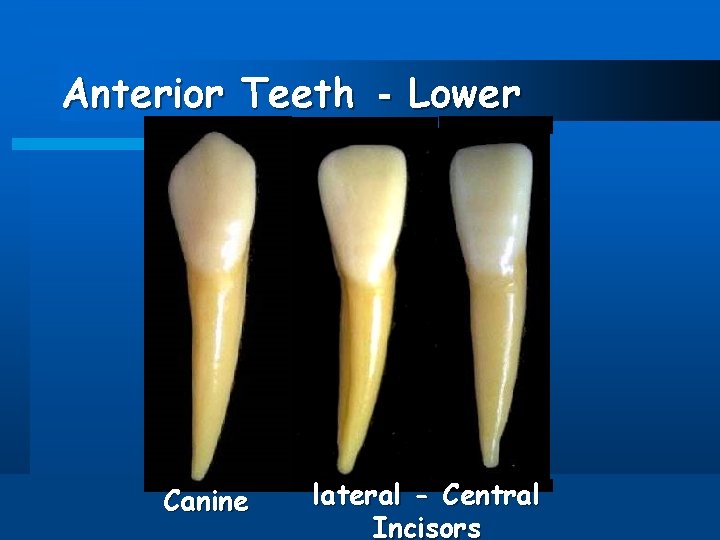 Anterior Teeth - Lower Canine lateral - Central Incisors 