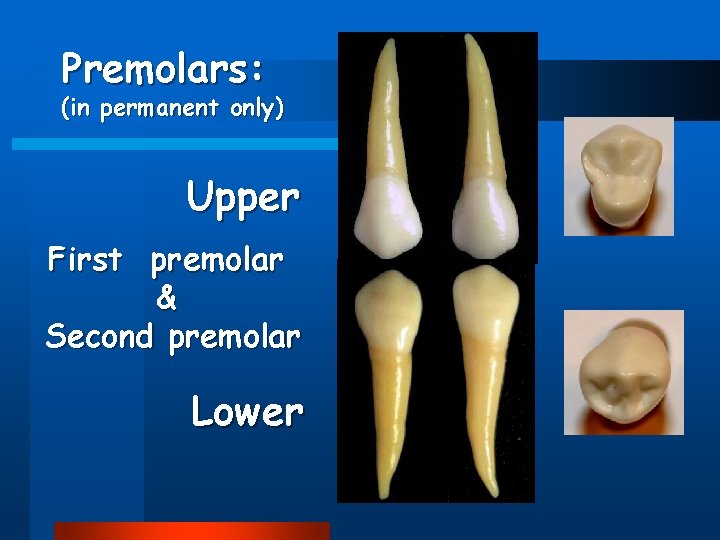 Premolars: (in permanent only) Upper First premolar & Second premolar Lower 