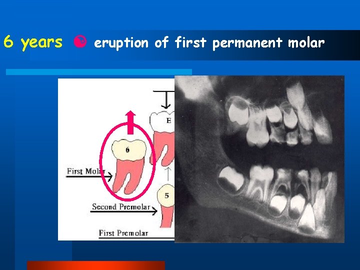 6 years eruption of first permanent molar 