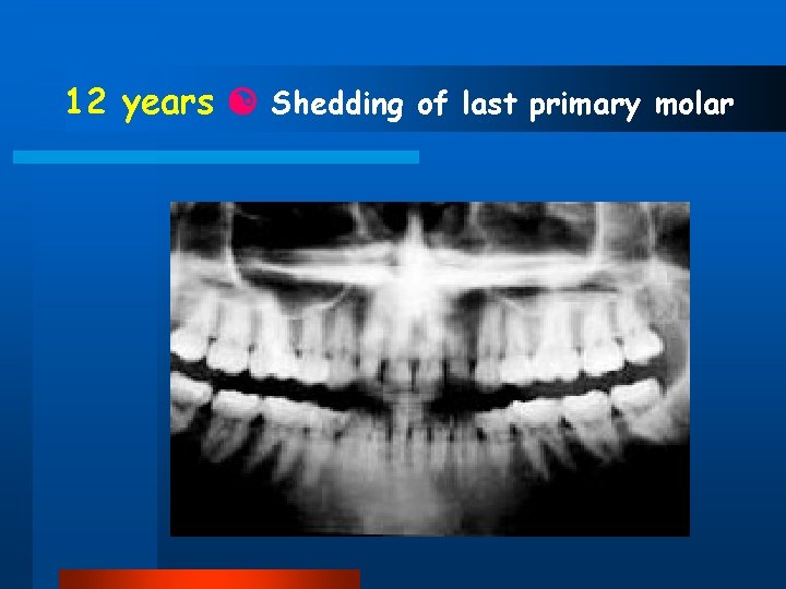 12 years Shedding of last primary molar 