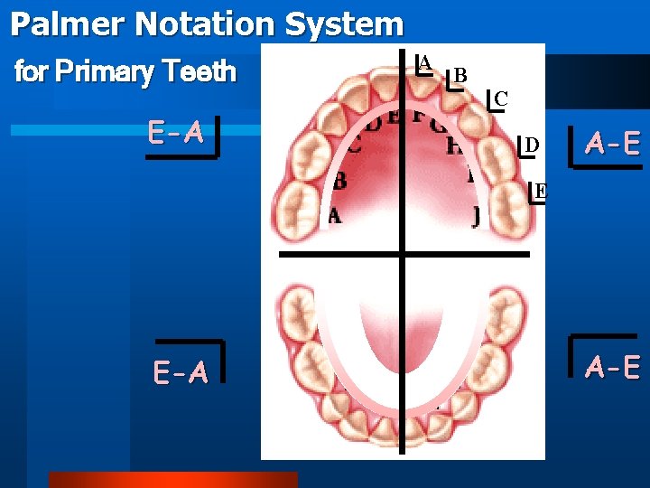 Palmer Notation System for Primary Teeth E-A A B C D A-E E E-A
