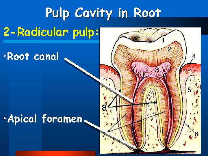 Pulp Cavity in Root 2 -Radicular pulp: • Root canal • Apical foramen 