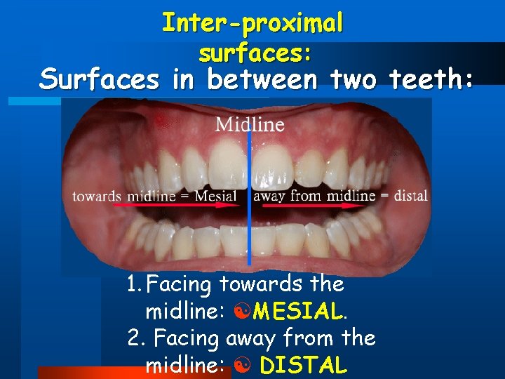 Inter-proximal surfaces: Surfaces in between two teeth: 1. Facing towards the midline: MESIAL. 2.