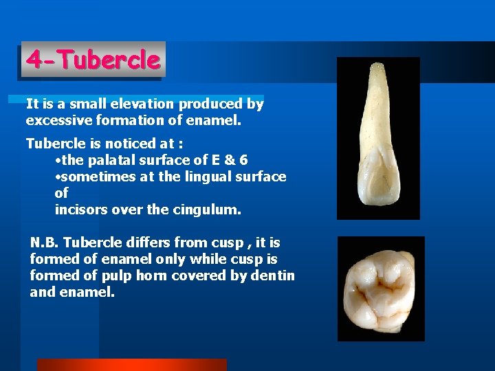 4 -Tubercle It is a small elevation produced by excessive formation of enamel. Tubercle