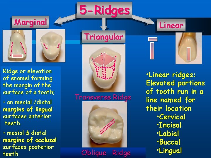 Marginal 5 -Ridges Triangular Ridge or elevation of enamel forming the margin of the