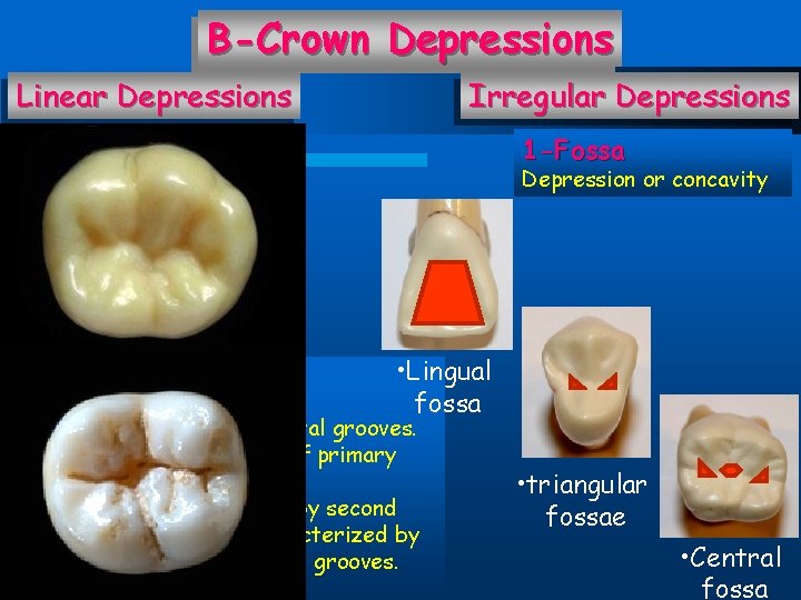 B-Crown Depressions Linear Depressions Irregular Depressions 1 -Developmental grooves: 1 -Fossa Depression or concavity