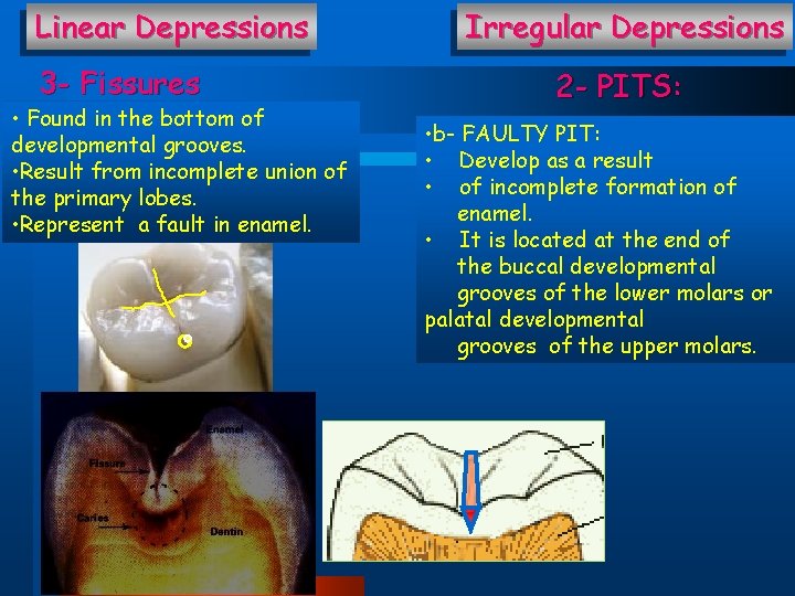 Linear Depressions 3 - Fissures • Found in the bottom of developmental grooves. •