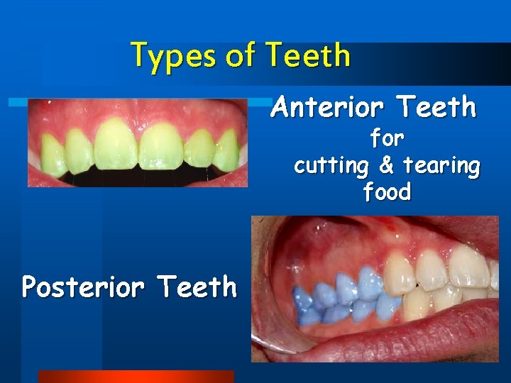 Types of Teeth Anterior Teeth for cutting & tearing food Posterior Teeth 