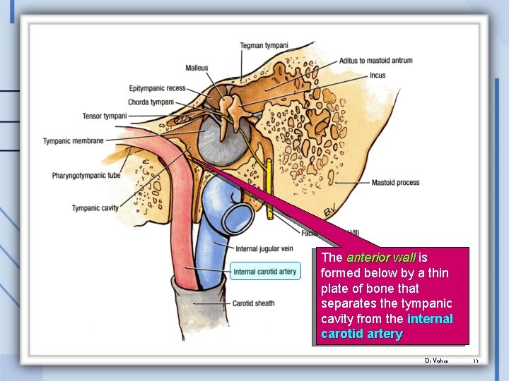 The anterior wall is formed below by a thin plate of bone that separates