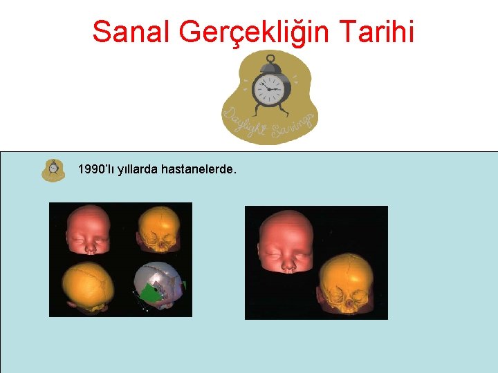 Sanal Gerçekliğin Tarihi 1990’lı yıllarda hastanelerde. 