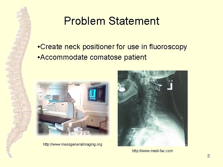 Problem Statement • Create neck positioner for use in fluoroscopy • Accommodate comatose patient