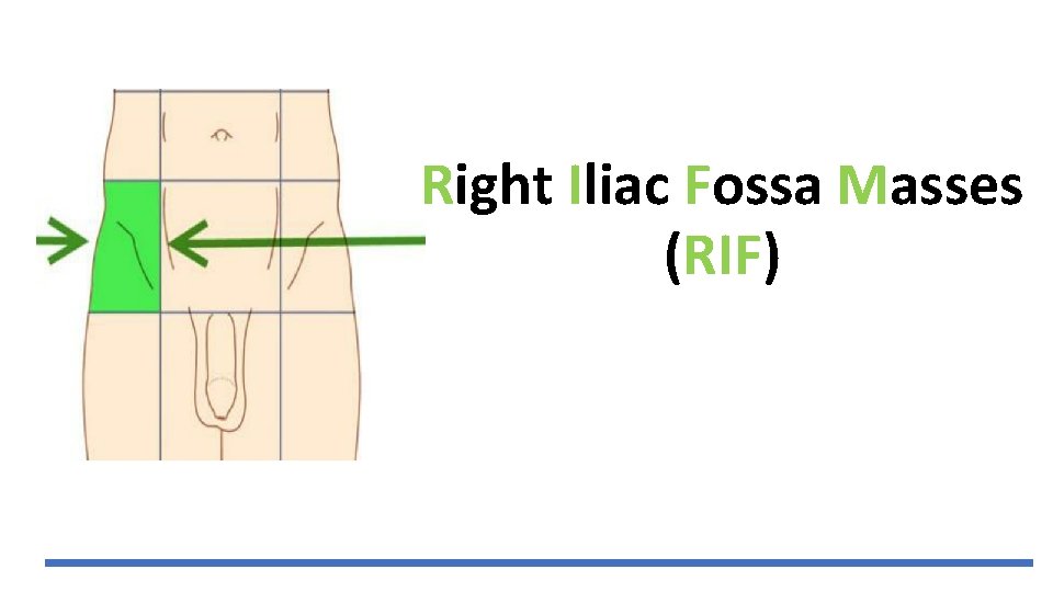 Right Iliac Fossa Masses (RIF) 