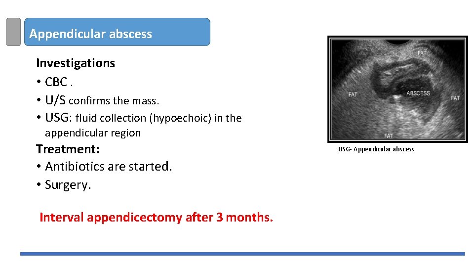 Appendicular abscess Investigations • CBC. • U/S confirms the mass. • USG: fluid collection