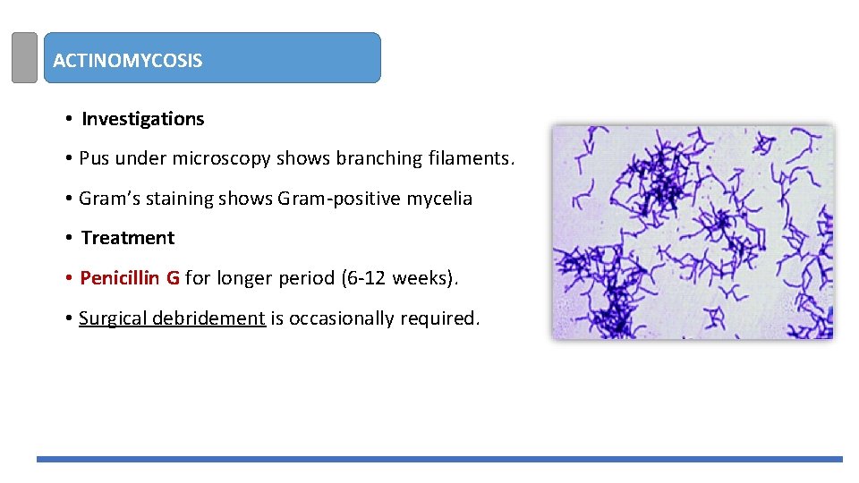 ACTINOMYCOSIS • Investigations • Pus under microscopy shows branching filaments. • Gram’s staining shows