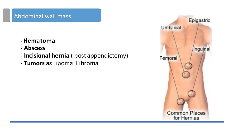 Abdominal wall mass - Hematoma - Abscess - Incisional hernia ( post appendictomy) -