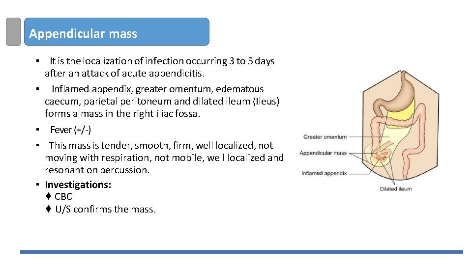 Appendicular mass ▪ It is the localization of infection occurring 3 to 5 days