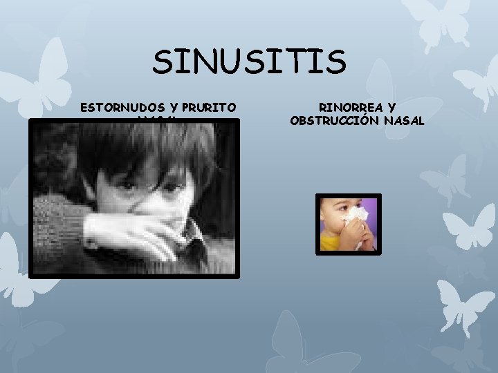 SINUSITIS ESTORNUDOS Y PRURITO NASAL RINORREA Y OBSTRUCCIÓN NASAL 