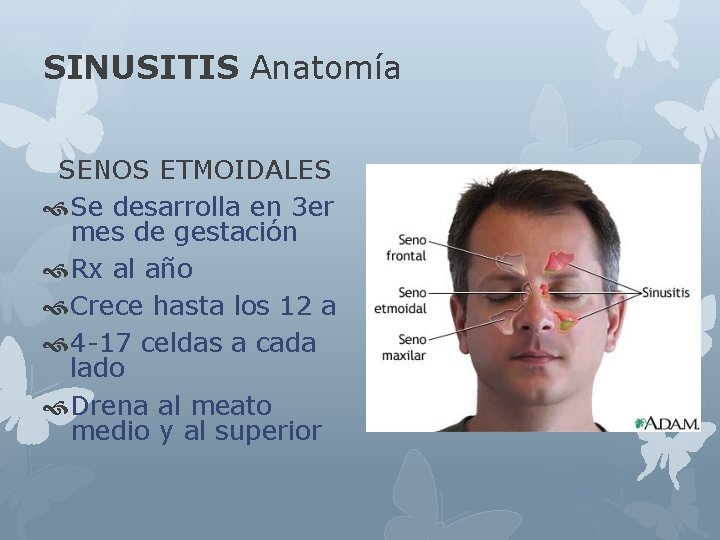 SINUSITIS Anatomía SENOS ETMOIDALES Se desarrolla en 3 er mes de gestación Rx al