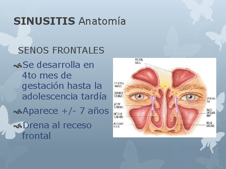 SINUSITIS Anatomía SENOS FRONTALES Se desarrolla en 4 to mes de gestación hasta la