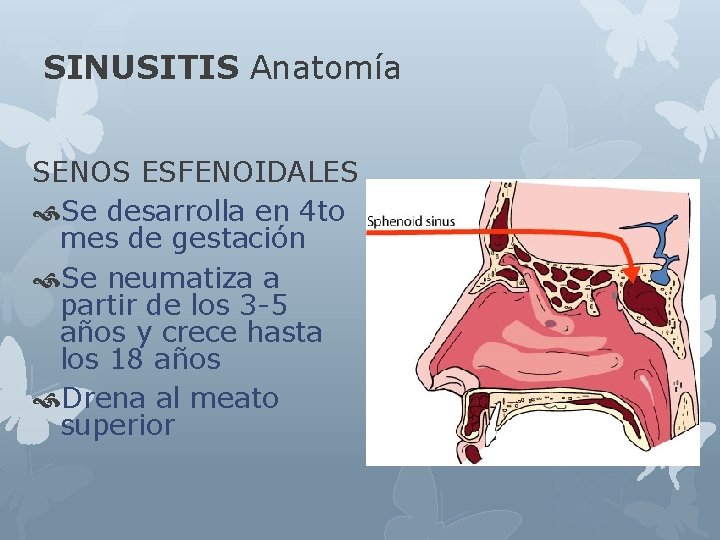 SINUSITIS Anatomía SENOS ESFENOIDALES Se desarrolla en 4 to mes de gestación Se neumatiza