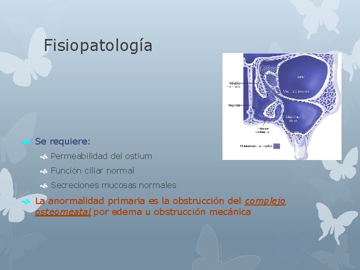 Fisiopatología Se requiere: Permeabilidad del ostium Función ciliar normal Secreciones mucosas normales La anormalidad
