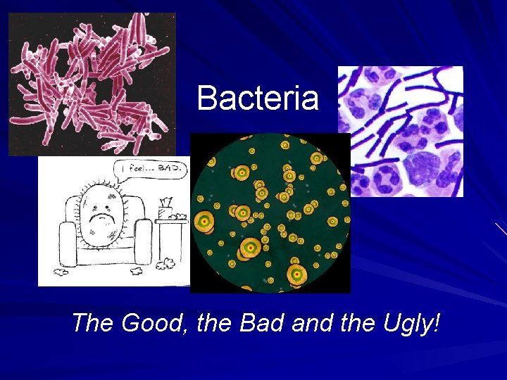 Bacteria The Good, the Bad and the Ugly! 
